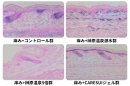 図1:痒みを発生させた皮膚のH&E染色の画像による分析 図1:痒みを発生させた皮膚のH&E染色の画像による分析