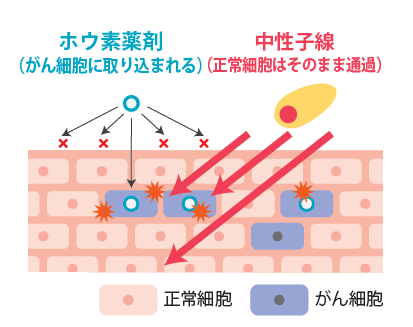 株式会社CICS（リゾートトラスト株式会社の連結子会社）、血管肉腫を対象としたBNCT（ホウ素中性子捕捉療法）の国内第II相臨床試験において主要評価項目を達成
