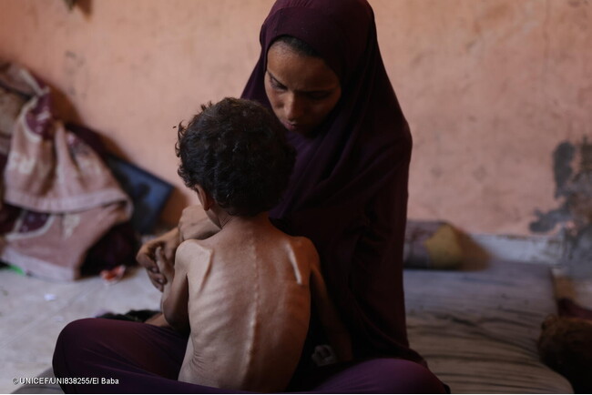 ガザ新分析、栄養指標が最悪に　ユニセフなど「飢きんの瀬戸際」と警告 【プレスリリース】