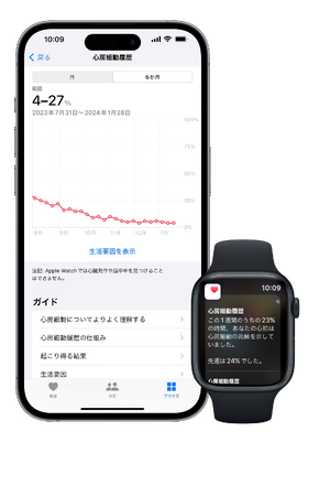 Apple Watchを活用した心房細動治療の新たな研究に着手