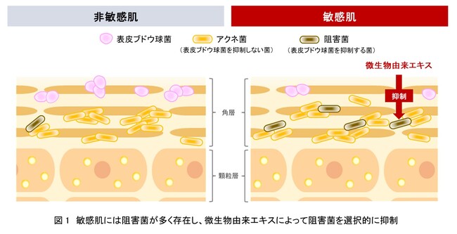資生堂、菌叢研究を通じて敏感肌には表皮ブドウ球菌の生育を阻害する特殊なアクネ菌が多いことを発見　～特殊なアクネ菌を選択的に抑制する効果を微生物由来エキスに発見～