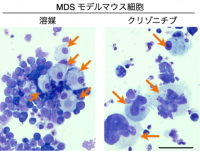 【東京薬科大学】既存肺がん治療薬クリゾチニブ新作用の発見！ ～骨髄異形成症候群の血小板減少症に対して巨核球造血促進により血小板産生を増加～