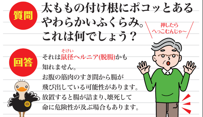 知っていますか？「予防できない」鼠径ヘルニア（脱腸） ──秋の活動シーズン前に知っておくべき症状と対処法
