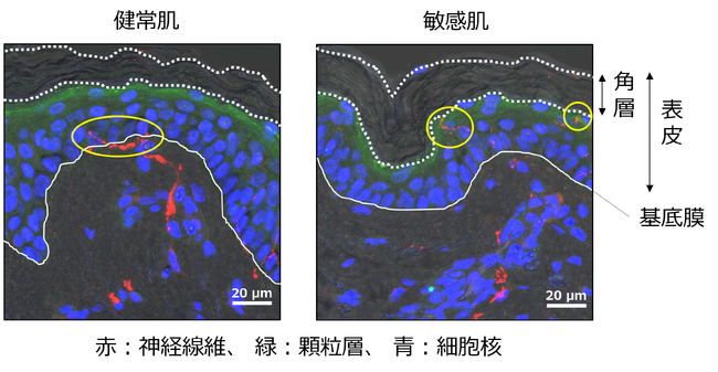 敏感肌における知覚過敏のメカニズムの一因を明らかに