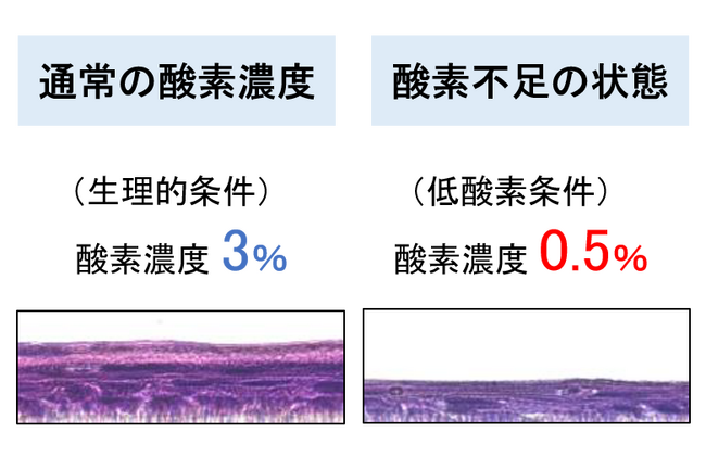 肌が薄くなるのは酸素不足? ~皮膚の低酸素状態が幹細胞に与える影響を解明~
