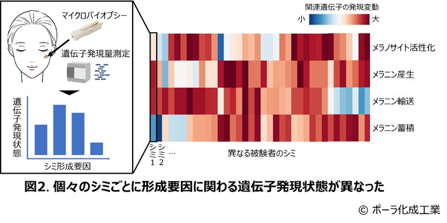 シミごとに形成要因は異なっていた