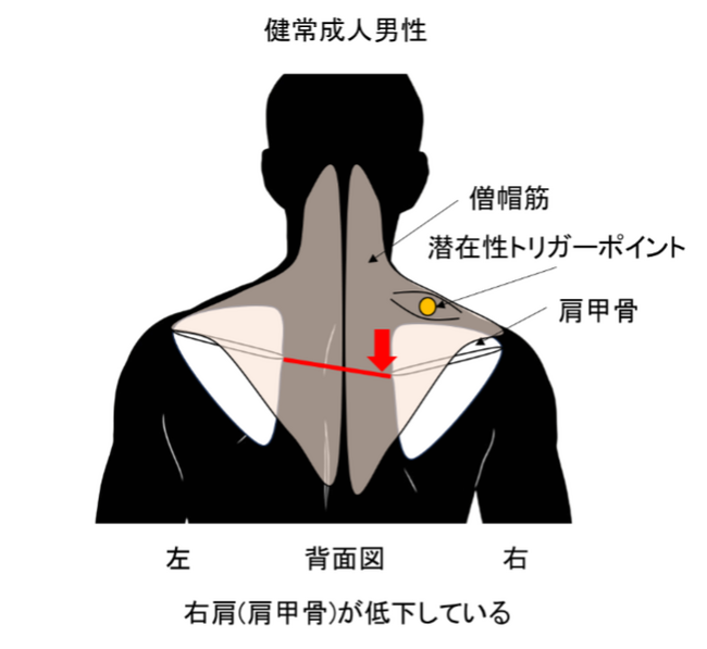 国際学術誌『PLOS One』に東亜大学との共同研究成果が掲載されました