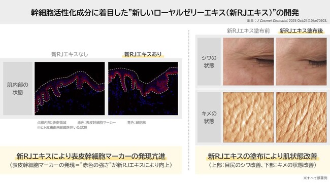 ローヤルゼリーに新知見　肌の角層水分量と真皮の厚みを向上させ、シワやキメを改善独自
