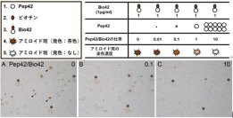 【東京医科大学】アルツハイマー病のアミロイド斑内における自己抗体の存在とその意義 ～抗体の二面性と治療薬開発におけるピットフォール～