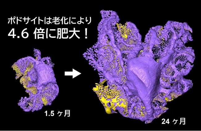 長寿命細胞ポドサイトが老化に抗い生存し、糸球体を維持するメカニズムを解明