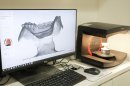 入れ歯データスキャンの様子 入れ歯データスキャンの様子