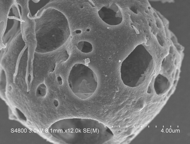 NK/T細胞リンパ腫の新たな治療法への道を拓く新規抗体「mAb ANAP」を開発