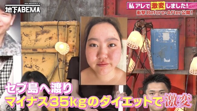 秋元康プロデュース『ラストアイドル』出身の元アイドルが衝撃の激変！1日6食の“暴飲暴食生活”により3ヶ月で20kg増の過去…セブ島で35kg減を叶えた“決死のダイエット留学”の全貌を公開