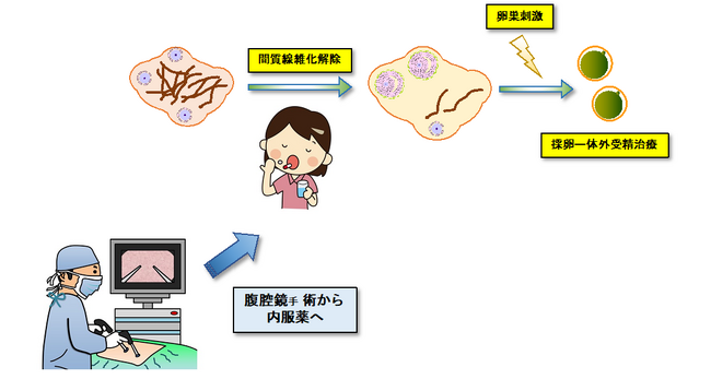 内服薬「フィネレノン」による早発閉経患者の新たな不妊治療法を開発