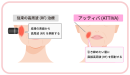 従来の高周波とATTIVA(アッティバ)の違い 従来の高周波とATTIVA(アッティバ)の違い