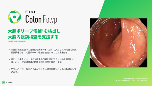 大腸ポリープ候補を検出し大腸内視鏡検査を支援する「EIRL Colon Polyp」、検出精度を改善した新モデルを発売