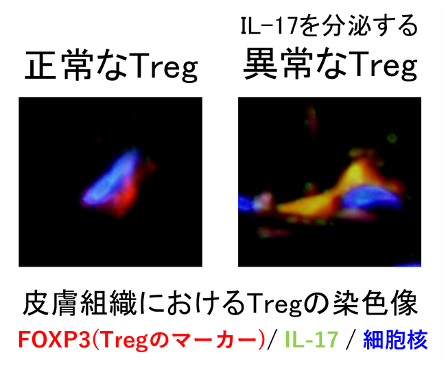免疫系細胞の異常が皮膚の老化を促進する新たなメカニズムを解明～制御性T細胞（Treg）の異常が老化細胞の蓄積を促進させる～