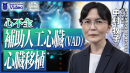 心不全_心不全 補助人工心臓(VAD)・心臓移植