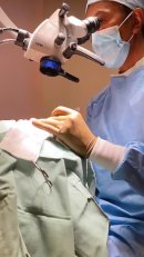 手術のイメージ 手術のイメージ