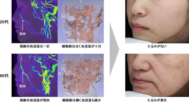 資生堂、加齢による深部血管の血流バランスの崩れが肌のたるみを引き起こすことを発見　～「べにばな」由来エキスとナイアシンアミドが血流を調整し、たるみ改善へ～