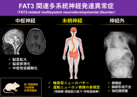 図1：FAT3遺伝子の異常による多系統神経発達障害 FAT3遺伝子の異常により、脳・神経・骨格にわたる複数の障害が生じることが明らかとなった。脳の構造異常、末梢神経障害による筋力低下、側弯などの骨格異常が特徴である。