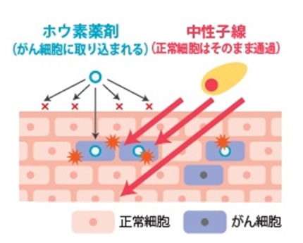 株式会社CICS（リゾートトラスト株式会社の連結子会社）、加速器を用いたBNCT治療システムの医療機器製造販売承認申請のお知らせ