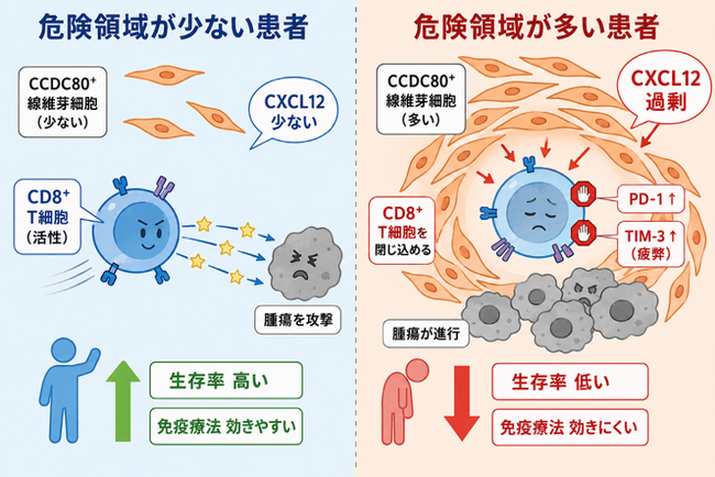 胃がんの進行を促進する「危険領域」を特定！― CCDC80陽性線維芽細胞による免疫抑制メカニズムの解明 ―