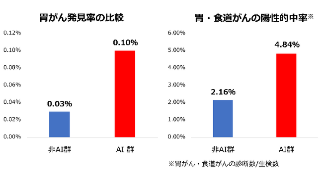 AI支援内視鏡が上部消化管がんの発見率を向上～大規模健診施設における約5万人のデータで実証～