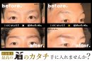 Before/After (2)
