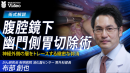 腹腔鏡下幽門側胃切除術