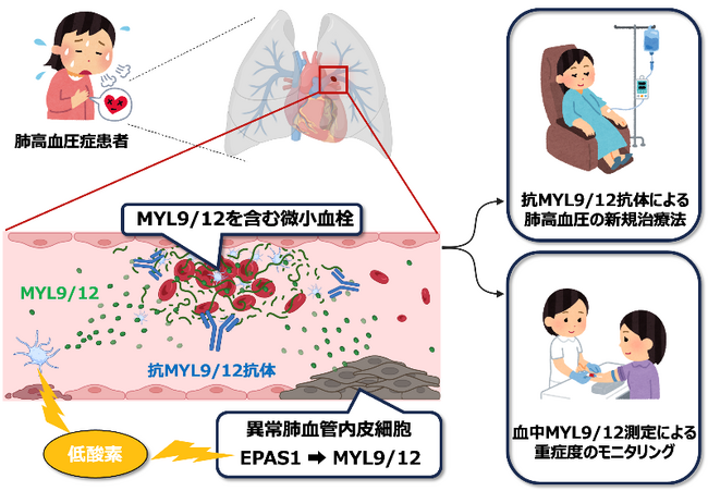 難治性疾患「肺高血圧症」の新たな治療標的を同定～血管構造の悪化を引き起こすタンパク質「MYL9/12」～