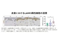 弘前大学大学院医学研究科の研究グループが岩木健康増進プロジェクトデータを用いて痛覚に関連する新しい一塩基多型を解明